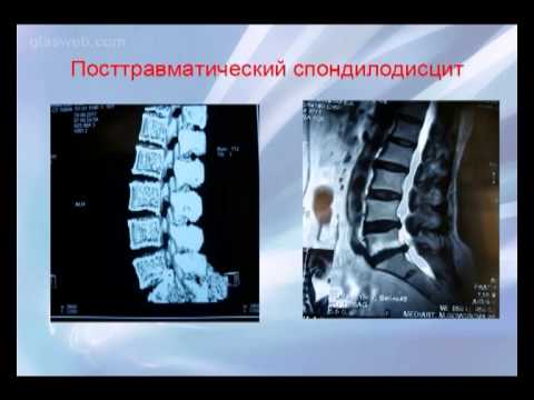 Сайед Муксен / 17 декабря 2013