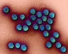 ТОП-5 вирусов, которые опаснее Эбола